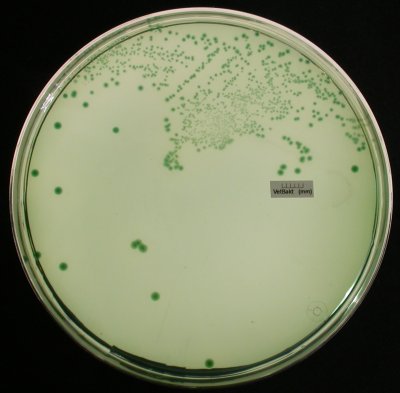 vibrio cholerae tcbs