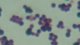 <p><b>Fig. 20:5.</b> Gram-färgning av <i>Staphylococcus aureus</i> subsp. <i>aureus</i>.</p>

<p> </p>