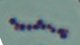 <p>Gram-färgning av <i>Streptococcus equi</i> subsp. <i>equi</i>.</p>

<p> </p>