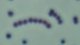 <p><strong>Fig. 15:5.</strong> Gram staining of <i>Streptococcus equi</i> subsp. <i>zooepidemicus</i>.</p>

<p> </p>