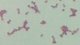 <b>Fig 17:3.</b> Gram staining of <i>Streptococcus dysgalactiae</i> subsp. <i>dysgalactiae</i>. The bacteria have not been evenly stained and the chains could be longer. <p>