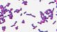 <p>Gram staining of <i>Renibacterium salmoninarum</i>, strain R.s 28/2.</p>

<p> </p>