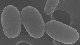 <p><strong>Fig. 179:1.</strong> Scanning electron micrograph of spores from <i>Paenibacillus larvae</i>, genotype ERIC I, strain 176-97. Three intact spores are visible in the center of the image. The total length of the scale bar is equivalent to 1 µm.</p>

<p> </p>