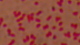 <strong>Fig. 55:3.</strong> Gram-färgning av <i>Bordetella pertussis</i>.
<p>