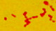 <p><strong>Fig. 57:2. </strong>Gram-färgning av <i>Actinobacillus pleuropneumoniae</i>, stam CCUG 12837T.</p>

<p> </p>