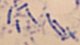 <p><strong>Fig. 104:2.</strong> Methylene blue (MB) staining of <i>Dichelobacter nodosus</i>, strain .... Note the typical dark granulae, particularly close to the ends, which can be visualized by MB staining.</p>

<p> </p>