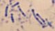 <p><strong>Fig. 104:2.</strong> Metylenblått- (MB-)färgning av <i>Dichelobacter nodosus</i>, stam .... Notera typiska mörka granulae, framför allt vid polerna, som framträder vid MB-färgning.</p>

<p> </p>