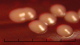 <strong>Fig. 135:2.</strong> Kolonier av <i>Staphylococcus pseudintermedius</i>, stam VB 001/09, odlad aerobt under ett dygn på nötblod-agar vid 37°C. Längden på hela skalstrecket motsvarar 5 mm.
<p>