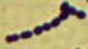 <strong>Fig. 15:4.</strong> Gram-färgning av <i>Streptococcus equi</i> subsp. <i>zooepidemicus</i>, stam VB 003/09. 
<p>