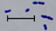 <p><b>Fig. 1:5.</b> Gramfärgning av <i>Trueperella pyogenes</i>, stam CCUG 13230<sup>T</sup>. Längden på skalstrecket motsvarar 5 µm. Datum: 2010-05-21.</p>

<p> </p>