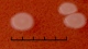 <p><b>Fig. 199:2.</b> Närbild på kolonier av <i>Mannheimia granulomatis</i>, stam BKT 20776/10, odlad aerobt under ett dygn på hematin-agar vid 37°C i närvaro av 5% CO<sub>2</sub>. Längden av hela skalstrecket motsvarar 5 mm. Datum: 2010-06-02.</p>

<p> </p>