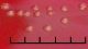 <p><b>Fig. 2.</b> Närbild på kolonier av <i>Erysipelothrix rhusiopathiae</i>, stam CCUG 221<sup>T</sup>, odlad aerobt under två dygn på hästblod-agar vid 37°C i närvaro av 5% CO<sub>2</sub>. Längden av hela skalstrecket motsvarar 5 mm. Datum: 2010-06-03.</p>

<p> </p>