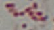 <p><strong>Fig. 199:3. </strong>Gram staining of <i>Mannheimia granulomatis</i>, strain BKT 20776/10. The length of the scale bar is equivalent to 5 µm. Date 20010-06-10.</p>

<p> </p>