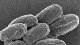 <p><strong>Fig. 11:5.</strong> Sporer av <i>Bacillus anthracis</i>. Denna stam är av biotyp Sterne. Olika stammar av <i>B. anthracis</i> bildar sporer, som kan vara av två morfologiska typer, antingen nästan sfäriska eller mer utsträckta. Den avbildade stammen bildar mer utstäckta sporer (jfr. Fig. 11:4.). Längden på skalstrecket motsvarar 1 µm. Datum: 2010-06-15.</p>

<p> </p>