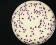 <p><b>Fig. 68:9. </b>Kolonier av <i>Escherichia coli</i>, odlad aerobt på "Chromogenic E. coli/coliform selective agar" under 24 timmar vid 30°C. Detta är ett medium, som används för att räkna coliforma bakterier. Mediet innehåller Rose-Gal och X-Glu med vars hjälp man kan detektera β-galaktosidas resp. β-glukoronidas. <i>E. coli</i> har båda enzymerna och ger lila kolonier, medan andra coliformer enbart har β-galaktosidas och alltså ger skära kolonier. ï¿½riga bakterier ger färglösa kolonier eller blå kolonier om de har β-glukoronidas. Längden på skalstrecket motsvarar 10 mm. Datum: 2010-06-17.</p>

<p> </p>