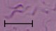 <b>Fig. 98:3.</b> Phase contrast micrograph of living <i>Brachyspira pilosicoli</i>, strain P43/6/78<sup>T</sup>. The length of the scale bar is equivalent to 5 µm. Cultures of <i>B. pilosicoli</i> often looks more messy than cultures of <i>B. hydysenteriae</i> (c.f. Fig. 97:3-4). Date: 2010-06-23. <p>