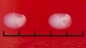 <b>Fig. 19:2.</b> Närbild på kolonier av <i>Streptococcus uberis</i> på nötblodagar efter odling under 24 tim vid 37°C. Längden på hela skalstrecket motsvarar 5 mm. Datum: 2010-10-02. <p>