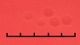 <b>Fig. 60:5.</b> Closeup of colonies of <i>Mannheimia haemolytica</i>, strain PAT 4483/10, after cultivation on horse blood agar during 24 h at 37°C in the presence of 5% CO<sub>2</sub>. Light from below. The total length of the scale bar is equivalent to 5 mm. Date: 2010-10-05. <p>