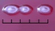 <b>Fig. 65:3.</b> Närbild på kolonier av <i>Pseudomonas aeruginosa</i>, stam ATCC 27853, odlad aerobt på hästblodagar under 3 dygn vid 37°C. Längden på hela skalstrecket motsvarar 5 mm. Datum: 2010-10-06. <p>