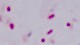 <p><b>Fig. 60:7.</b> Gram staining of <i>Mannheimia haemolytica</i>, strain PAT 4483/10. The length of the scale bar corresponds to 5 µm. Date: 2010-10-06.</p>

<p> </p>