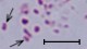 <p><b>Fig. 60:8.</b> Gramfärgning av <i>Mannheimia haemolytica</i>, stam PAT 4483/10. Bakterierna vid pilarna håller troligen på att dela sig. Längden på skalstrecket motsvarar 5 µm. Datum: 2010-10-06.</p>

<p> </p>