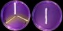 <p><b>Fig. 22:3.</b> Stryk av <i>Staphylococcus</i> spp. odlad aerobt på blåagar (med maltos) vid 37° C under 24 timmar. 1: <i>S. intermedius</i>, 2: <i>S. aureus</i> subsp. <i>aureus</i>, 3: <i>S. epidermidis</i>. Notera att <i>S. intermedius</i> ej fermenterar maltos på blåagarplatta till skillnad från övriga <i>Staphylococcus</i> spp. Datum: 2011-03-06.</p>

<p> </p>