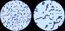 <p><b>Fig. 16:6.</b> Gram-färgning av <i>Streptococcus agalactiae</i>, stam 09mas018883. Endast förstoringsgrad skiljer de båda bilderna åt. Längden på skalstrecken motsvarar i båda bilderna 5 µm. Datum: 2011-04-11.</p>

<p> </p>