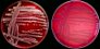 <p><b>Fig 69:1.</b> Kolonier av <i>Klebsiella pneumoniae</i> subsp. <i>pneumoniae</i>, stam CCUG 225, odlad aerobt på hästblodagar vid 37 °C under 24 tim. A, Fotograferad med ljus ovanifrån. B, Fotograferad med ljus huvudsakligen underifrån. Notera att någon hemolyszon ej kan observeras. Längden av skalstrecket motsvarar 1 cm. Datum: 2011-06-16.</p>

<p> </p>