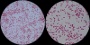 <p><b>Fig. 53:4</b>. Gram staining av <i>Bordetella bronchiseptica</i>, strain xxx. B is a partial close-up of A.</p>

<p> </p>