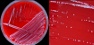 <p><strong>Fig. 169:1.</strong> Kolonier av <i>Corynebacterium kutscheri</i>, stam JF5392, odlad på TSA med 5% fårblod under 24 tim vid 37 °C och med 5% CO<sub>2</sub>. Stammen har isolerats från en patologiskt förändrad lymfknuta i en lunga från en mus. A, översikt av hela agarplattan. Hela längden av skalstrecket motsvarar 1 cm. B, delförstoring av A. Hela längden av skalstrecket motsvarar 5 mm. Notera de mycket små kolonierna.</p>

<p> </p>