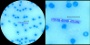 <p><strong>Fig. 11:3.</strong> Kapselfärgning med metylenblått av <em>Bacillus anthracis</em> i blodutstryk. En "kedja" av bakterier syns under skalstrecken. Den högra bilden är en delförstoring av den vänstra. Längderna av skalstrecken motsvarar 10 µm i båda bilderna.</p>

<p> </p>