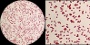 <p><strong>Fig. 68:3.</strong> Gramfärgning av <i>Escherichia coli</i>, stam VB 008/14. Den högra bilden är en delförstoring (ca 2,5x) av den vänstra. Hela längden av respektive skalstreck motsvarar 5 µm och skalorna är placerade i motsvarande delar av bilderna. Datum: 2013-12-22.</p>

<p> </p>

<p> </p>