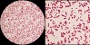 <p><strong>Fig. 73:3.</strong> Gram staining of <i>Proteus vulgaris</i>, strain SLV 476. The right image is a partial magnification (2.5x) of the left one. The total length of the respective scale bars is equivalent to 5 µm and the scale bars are placed in the corresponding areas of the images. Date: 2013-12-23.</p>

<p> </p>

<p> </p>