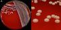 <p><strong>Fig. 23:1.</strong> Kolonier av <i>Staphylococcus hyicus</i> odlad på nötblodagar under 24 timmar vid 37° C. Plattan är fotograferad med belysning från ovan. A, hela plattan. B, delförstoring av A. Den totala längden på skalstrecken motsvarar 1 cm resp. 5 mm. Datum: 2014-10-24.</p>

<p> </p>