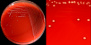 <strong>Fig. 17:1.</strong> A. Kolonier av <i>Streptococcus dysgalactiae</i> subsp. <i>dysgalactiae</i> odlad på nötblodagar vid 37 °C under 24 timmar. Agarplattan fotograferades <strong>med ljus ovanifrån</strong>. B. Delförstoring av agarplatan t.v. Här ser man den svaga α-hemolysen, men den syns tydligare med ljus underifrån (se Fig. 17:2). Hela längden av skalstrecken motsvarar 1 cm resp. 5 mm. Datum: 2014-11-14.</p>