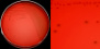 <strong>Fig. 17:2.</strong> A. Colonies of <i>Streptococcus dysgalactiae</i> subsp. <i>dysgalactiae</i> cultivated on bovine blood agar at 37 °C during 24 h. The agar plate was photographed <strong>with light from below</strong>. B. Close-up of some colonies from the agar plate to the left. The weak greenish α-hemolysis is visible in the panel. The total length of the scale bars is equivalent to 1 cm and 5 mm, respectively. Date: 2014-11-12.</p>