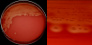 <p><strong>Fig. 14:2.</strong> Bild A. Kolonier av <i>Streptococcus equi</i> subsp. <i>equi</i> odlad på nötblodagar vid 37 °C under 48 timmar. Agarplattan fotograferades <strong>med ljus underifrån</strong>. Bild B. Delförstoring av agarplatan t.v. Den klara β-hemolysen syns tydligt i båda bilderna. Hela längden av skalstrecken motsvarar 1 cm resp. 3 mm. Datum: 2014-11-19.</p>

<p> </p>