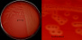 <p><strong>Fig. 16:2.</strong> A. Kolonier av <i>Streptococcus agalactiae</i>, stam VB 0006/11, odlad på nötblodagar vid 37 °C under 24 timmar. Agarplattan fotograferades <strong>med ljus underifrån</strong>. B. Delförstoring av agarplatan t.v. Den klara Î²-hemolysen syns tydligt på båda bilderna. Denna stam har en förhållandevis bred hemolyszon. Hela längden av skalstrecken motsvarar 1 cm resp. 3 mm. Datum: 2014-11-19.</p>