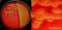 <p><strong>Fig. 121:2.</strong> Kolonier av <i>Streptococcus dysgalactiae</i> subsp. <i>equisimilis</i>, stam CCUG 36637, odlad aerobt på nötblodagar under 24 timmar vid 37 °C. Belysning kommer underifrån och man kan lätt se hemolysen (jfr. Fig. 121:1). B visar en närbild av plattan i A. Längden av hela skalstrecken motsvarar 10 och 3 mm i A resp. B. Datum: 2015-09-02.</p>

<p> </p>