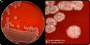 <p><strong>Fig 12:1.</strong> <em>Bacillus licheniformis</em>, odlad aerobt på nötblodagar under ett dygn vid 37° C. Bild A visar hela plattan och bild B en delförstoring. Längden på hela skalstrecken i bild A och i bild B motsvarar 10 resp. 6 mm.</p>

<p>Datum: 2020-06-25.</p>