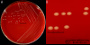 <p><strong>Fig. 103:1.</strong> Colonies of <i>Fusobacterium necrophorum</i> subsp. <i>necrophorum</i> cultivated on an FAA plate at 37°C during 48 h. Panel A shows the whole plate and panel B shows a close-up. The total length of the scale bars is equivalent to 10 and 3 mm, respectively. Date: 2016-09-08.</p>

<p> </p>