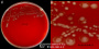 <p><strong>Fig. 26:1.</strong> Kolonier av <i>Clostridioides difficile</i>, stam ???, odlad anaerobt på en FAA-platta vid 37 °C under 48 tim. Bild A visar hela plattan och bild B visar en delförstoring där man tydligt kan se de oregelbundna och något diffusa kolonierna. Längden av hela skalstrecken motsvarar 10 resp 5 mm. Datum: 2016-09-08</p>

<p> </p>