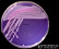 <p><strong>Fig. 86:4.</strong> Colonies of <i>Aeromonas hydrophila</i> subsp. <i>hydrophila</i> cultured on purple agar during 24 h at 37°C. The image shows that this bacterium grows well on purple agar, but it does not ferment lactose (no colour change on the plate. The total length of the scalebar is equivalent to 1 cm. Date: 2016-10-11.</p>

<p> </p>