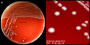 <strong>Fig. 124:1.</strong> Kolonier av <i>Enterococcus faecalis</i>, stam CCUG 9997, odlad på nötblodagar under 24 timmar vid 37 °C. Bilden A visar hela plattan och bilden C är en delförstoring. Den totala längden av skalstrecken motsvarar 10 resp. 3 mm. Datum: 2016-10-17.</p>