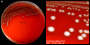 <strong>Fig. 190:1.</strong> Kolonier av <i>Enterococcus faecium</i>, VRE-stam, odlad på nötblodagar under 24 timmar vid 37 °C. Bilden A visar hela plattan och bilden C är en delförstoring. Den totala längden av skalstrecken motsvarar 10 resp. 3 mm. Datum: 2016-10-18.</p>