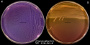 <p><strong>Fig. 72:3.</strong> Stryk av <i>Proteus mirabilis</i> på blåagar (A) och MacConkeyagar (B) efter odling under 24 timmar vid 37 °C. Notera att <i>Proteus</i> sp. svärmar på blåagar, men inte på MacConkeyagar. Längden av skalstrecken motsvarar 1 cm. Datum: 2016-10-19.</p>

<p> </p>