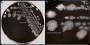 <p><strong>Fig. 89:4.</strong> Colonies of<em> Campylobacter jejuni</em> subsp. <em>jejuni</em> cultivated under microaerophilic conditions on modified CCD agar agar during 2 days at 41.5°C. Image A shows the whole plate and image B is a partial close-up of some colonies with typical irregular edge and metallic sheen. The length of the scale bar is equivalent to 1 cm, respectively. Date: 2017-09-11.</p>

<p> </p>