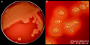 <p><strong>Fig. 126:1</strong> Kolonier av <i>Dermatophilus congolensis</i> odlade på blodagar under 5 dygn vid 37°C och i 5% CO<sub>2</sub>. Notera den kraftiga hemolysen och den oregelbundna kanten på kolonierna. Bild A visar hela plattan och bild B en delförstoring. Längden av skalstrecken motsvarar 1 cm resp. 5 mm. Datum: 2017-08-29.</p>