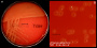 <b>Fig. 1:1.</b> Kolonier av <i>Trueperella pyogenes</i>, odlad aerobt under två dygn på nötblod-agar vid 37°C i närvaro av 5% CO<sub>2</sub>. Plattan är fotograferad med ljus underifrån för att Î²-hemolysen ska framträda tydligt. Bild B är en delförstoring av plattan i bild A. Längden av skalstrecken motsvarar 1 cm resp. 5 mm. Datum: 2017-10-04<p>