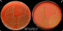 <p><strong>Fig. 147:1.</strong> Kolonier av <i>Streptococcus suis</i>, odlad på hästblodagar i närvaro av 5 % CO<sub>2</sub> under 1 dygn vid 37°C. Bild A och B visar en α-hemolyserande stam av <em>S. suis </em>till vänster och en ß-hemolyserande stam av <em>S. suis</em> till höger<em>. </em>Bild A är fotograferad med ljus ovanifrån och bild B med ljus underifrån där man lättare kan se hemolysen. Se också Fig. 147:2. Längden på skalstrecket motsvarar 1 cm. Datum: 2018-06-14.</p>